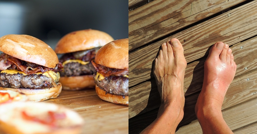 5 Penyebab asam urat dan kolesterol serta pencegahannya