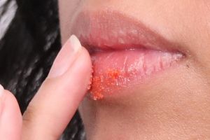 23 Cara mengatasi bibir hitam agar kembali cerah