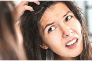 10 Cara menghilangkan ketombe dengan lidah buaya, mudah & ampuh