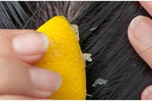 8 Cara menghilangkan ketombe dengan lemon, aman & ampuh