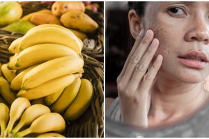 10 Manfaat pisang untuk kecantikan, cegah jerawat & penuaan