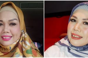 Elly Sugigi ungkap biaya potong gigi, harganya mengejutkan