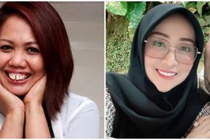 6 Potret transformasi Elly Sugigi, awal karier hingga potong gigi