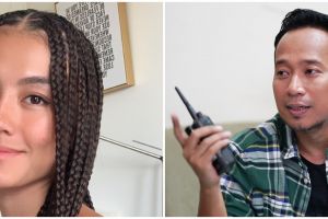 Agnez Mo sakit, komentar Denny Cagur ini jadi sorotan warganet