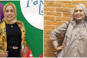 Usai potong gigi, ini kata Elly Sugigi soal nama barunya