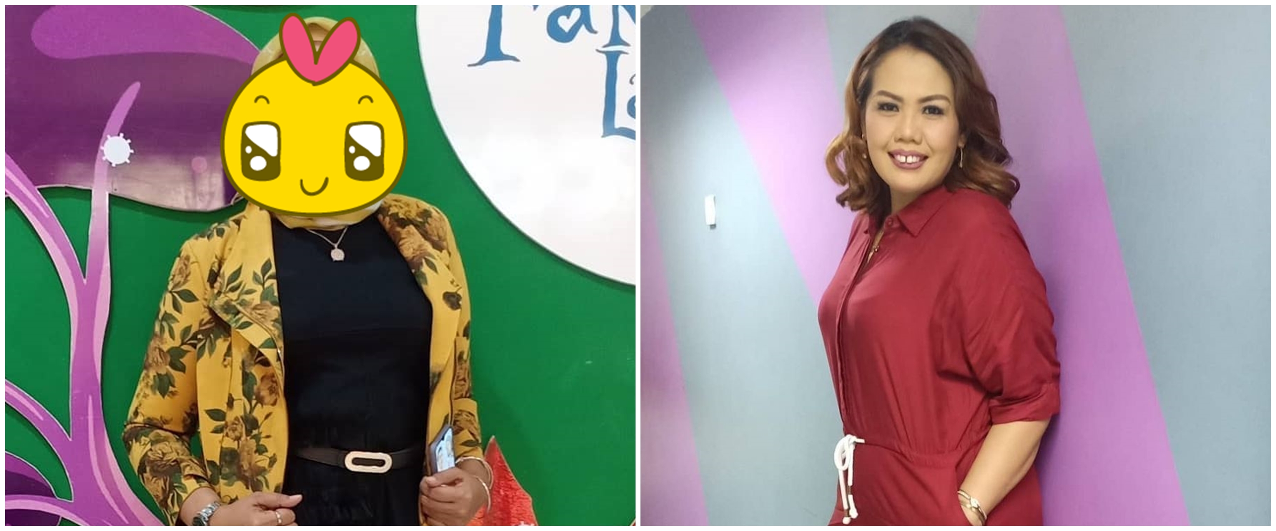 8 Beda penampilan Elly Sugigi sebelum vs sesudah potong gigi