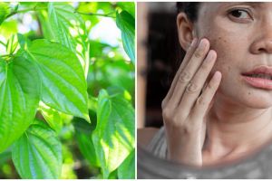12 Manfaat daun sirih untuk kecantikan, mencegah jerawat