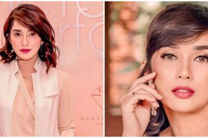 7 Potret perubahan wajah Ussy Sulistiawaty yang akui tanam benang