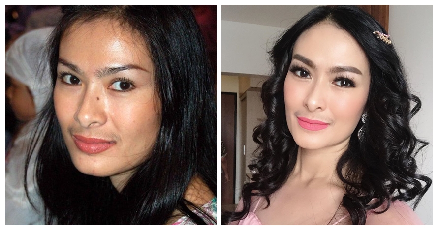 Potret 7 penyanyi sebelum vs sesudah tanam benang, manglingi