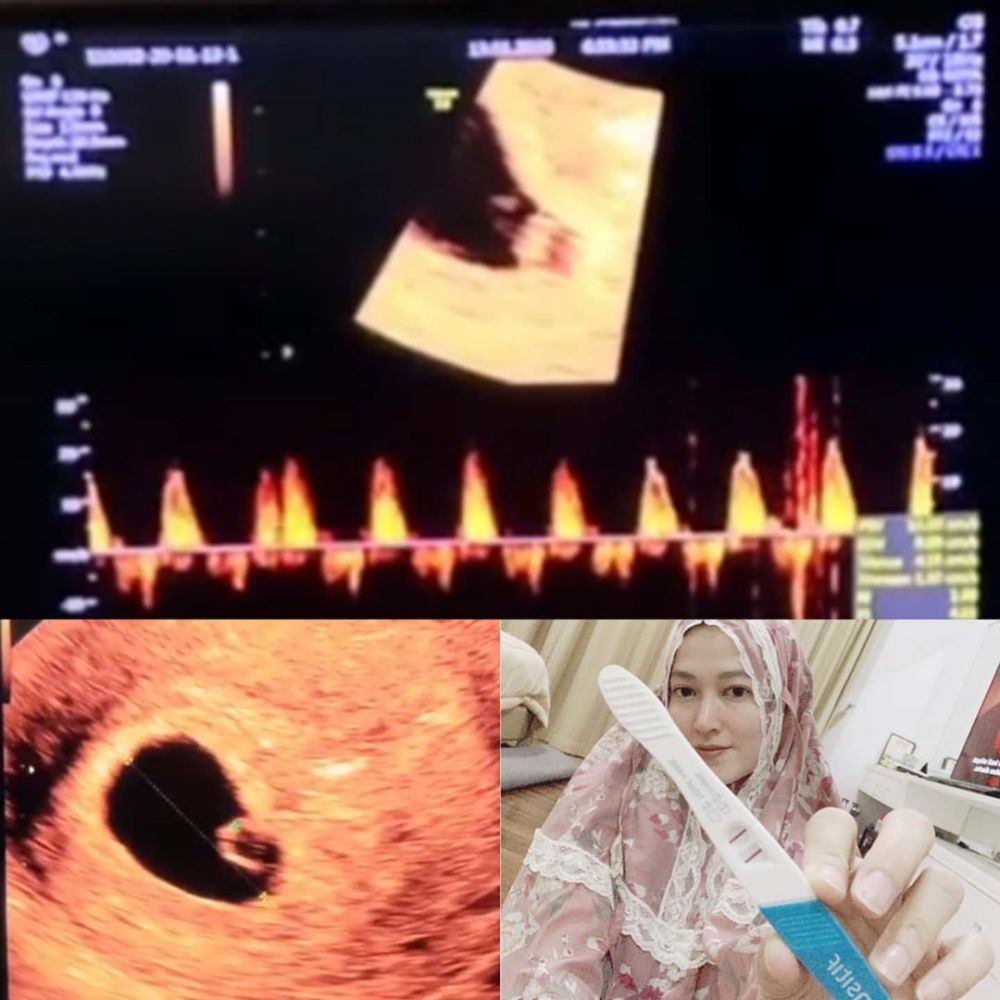 7 Tahun menanti, ini doa Fadlan Muhammad untuk kehamilan istri