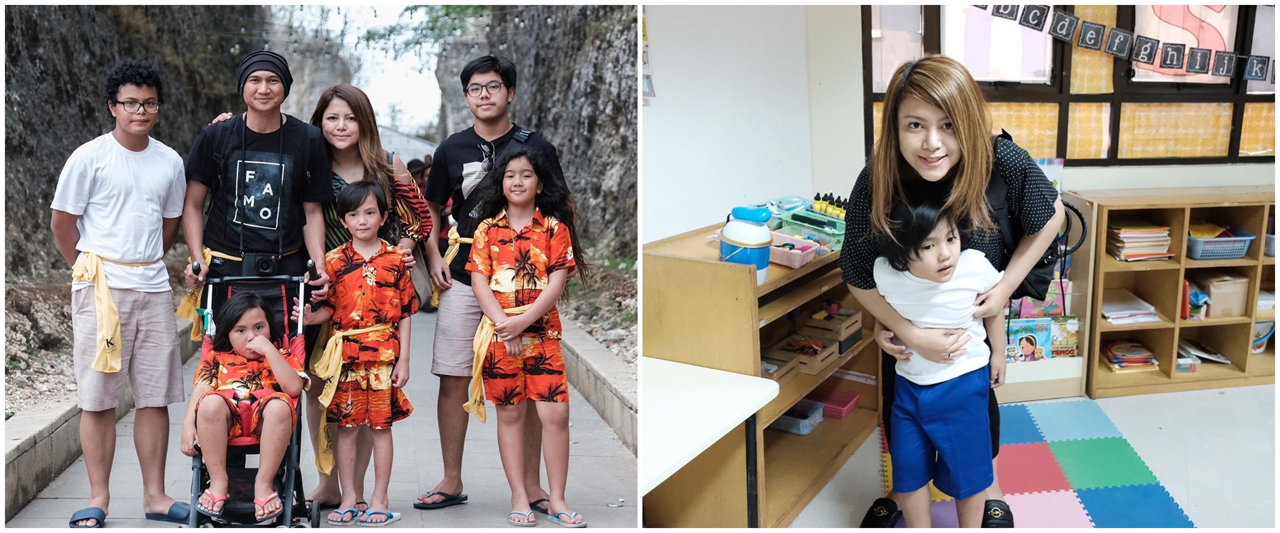 Pelipis anak bungsu Anji sobek hingga harus jalani operasi