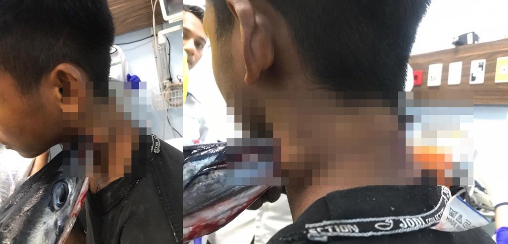 leher tertembus ikan sori © Facebook/iwan.koi.904