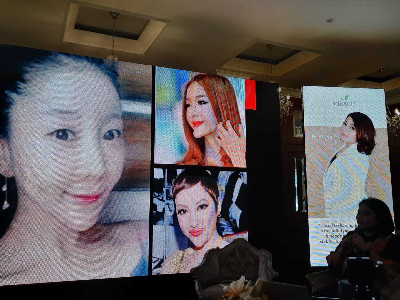 VShape, tren kecantikan terbaru 2020 yang bikin wajah tirus