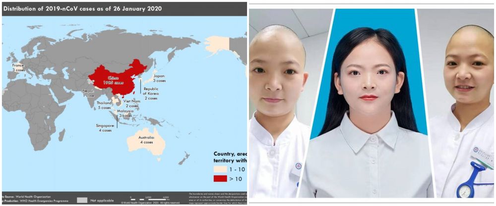 Kisah perawat Wuhan botaki kepala demi cegah infeksi virus Corona