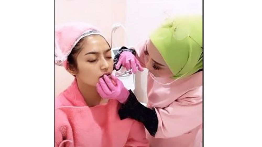 6 Potret terbaru Siti Badriah usai filler bibir, makin seksi