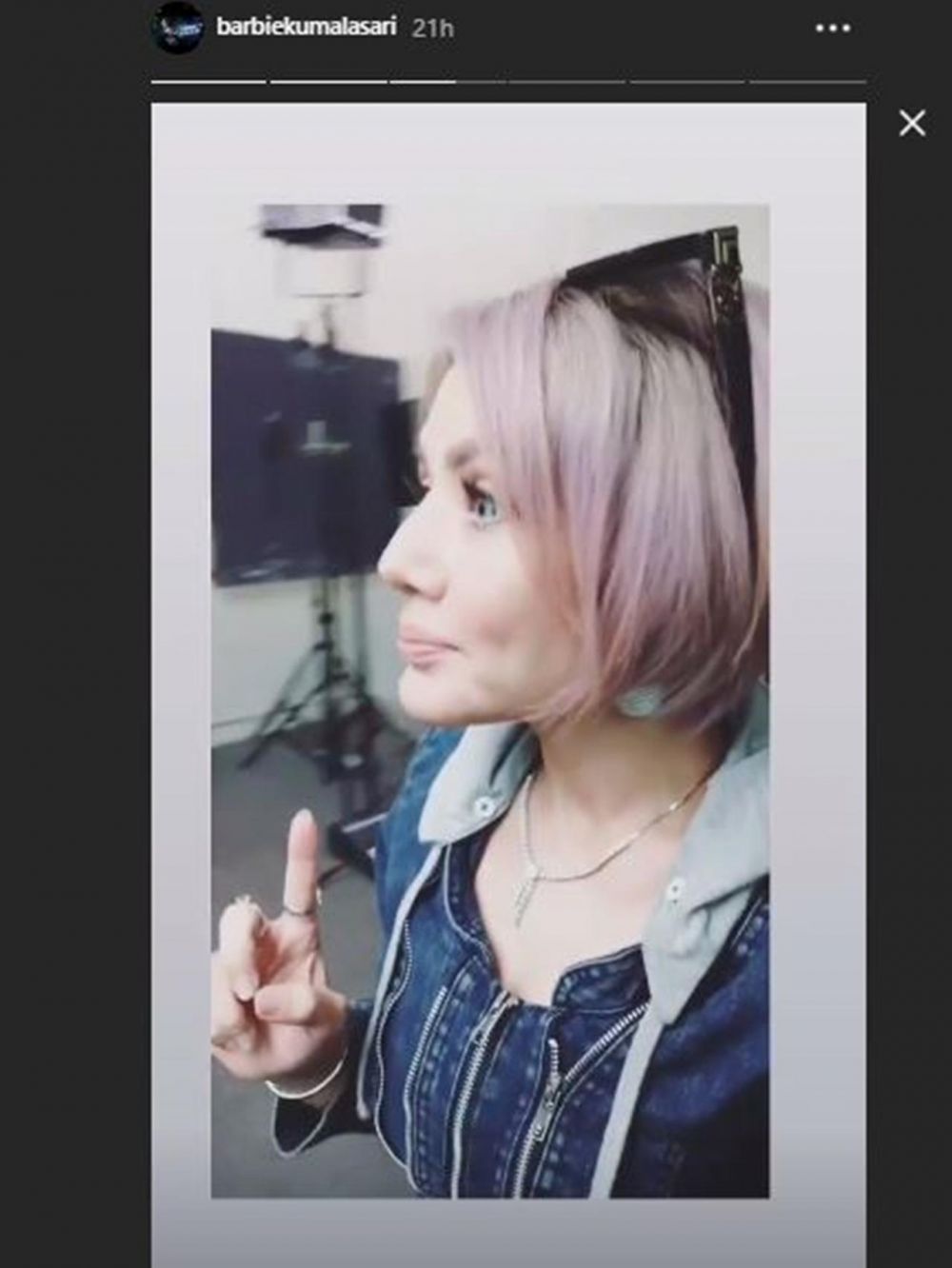 5 Foto terbaru Barbie Kumalasari usai operasi hidung, jadi sorotan