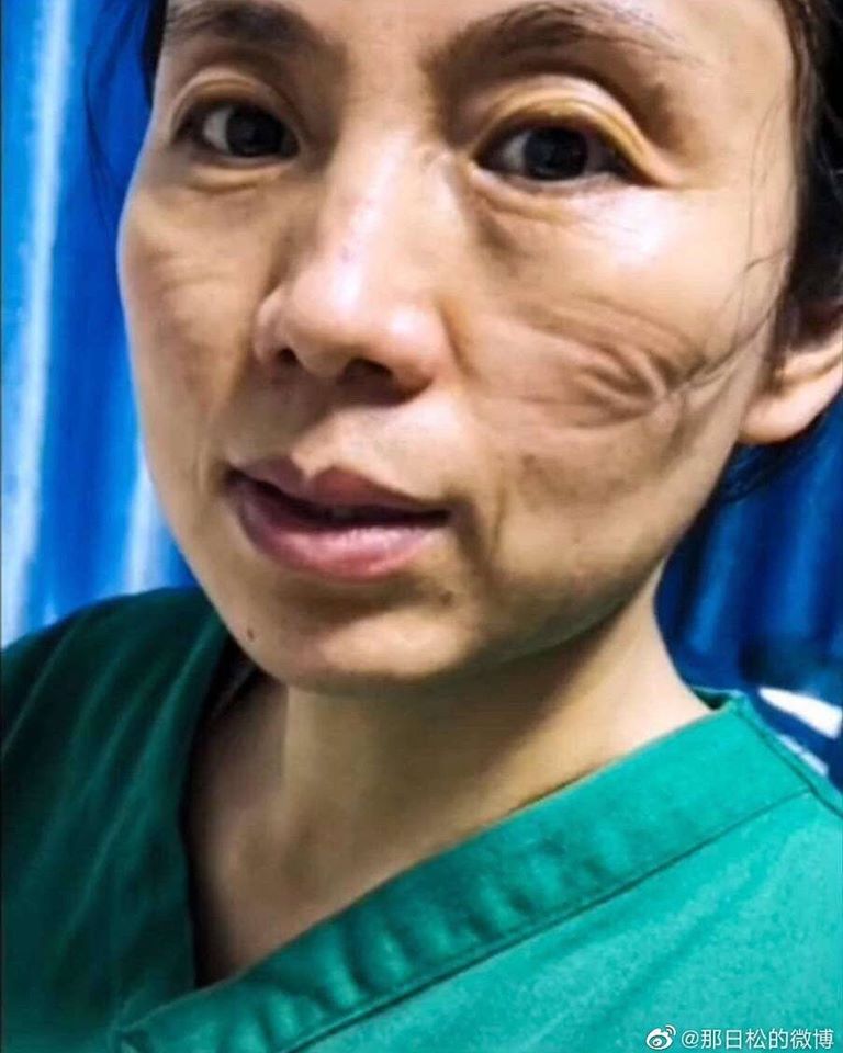 10 Potret kerja keras perawat dan dokter di Wuhan, totalitas