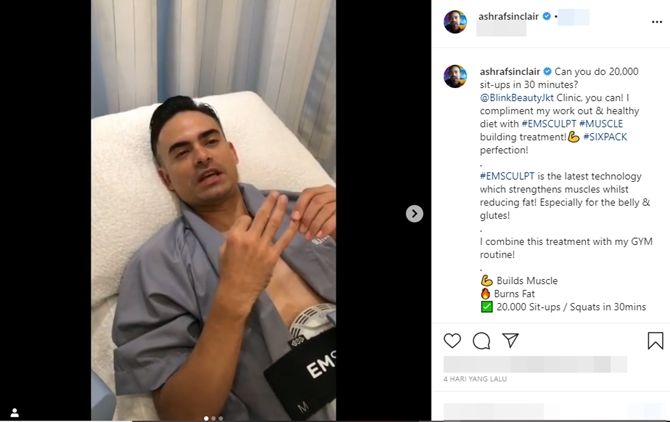 Ashraf Sinclair meninggal karena serangan jantung, ini gaya hidupnya