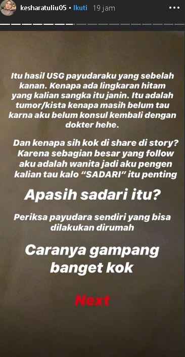 Dihujat usai unggah hasil USG payudara, ini curhatan Kesha Ratuliu