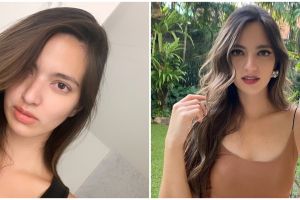 Jika Nia Ramadhani ditawari oplas, ini bagian tubuh yang diubah