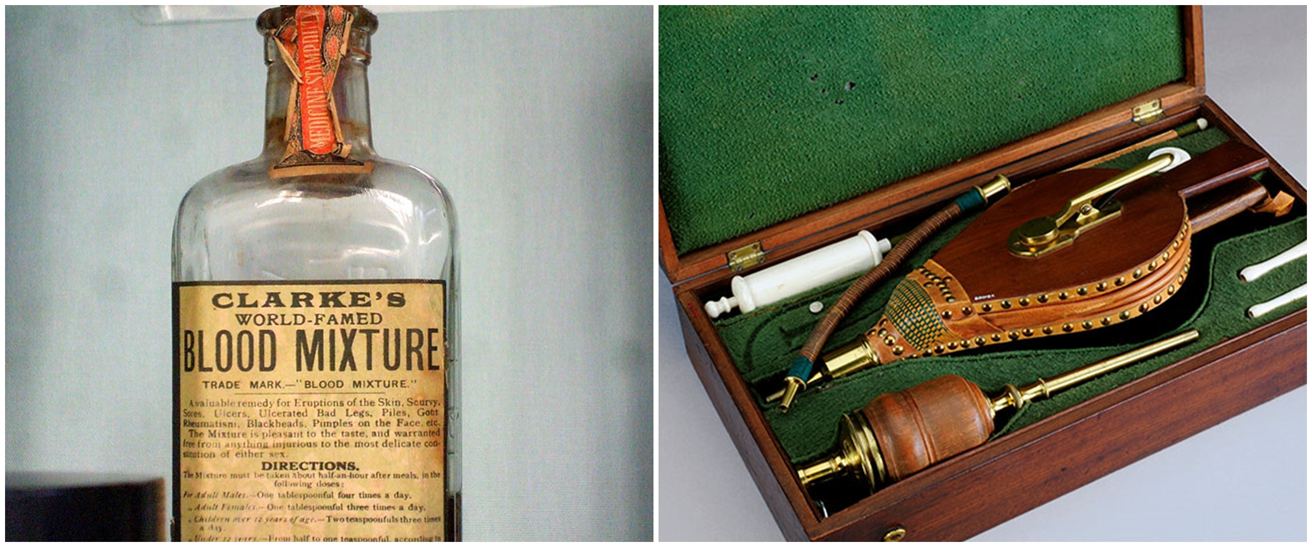10 Penemuan obat-obatan di masa dulu, unik-unik