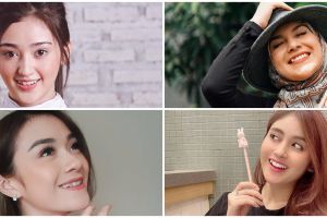 Pesona 15 seleb bergigi gingsul, manisnya bikin gagal fokus