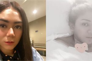 Kisah haru perjuangan Thalita Latief lawan tumor tiroid