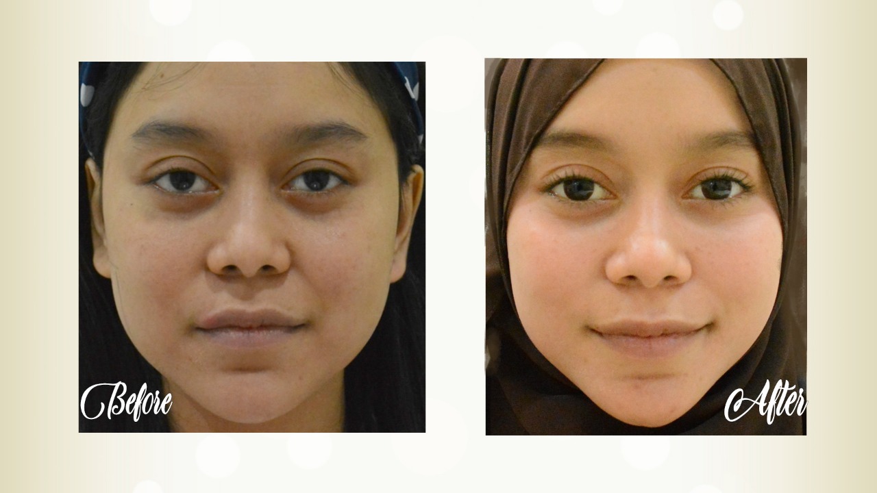 Vintagen, perawatan kecantikan mampu tingkatan sistem imun tubuh