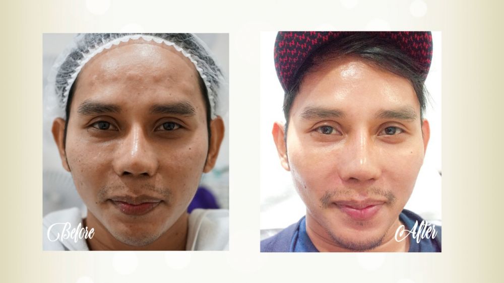 Vintagen, perawatan kecantikan tingkatkan sistem imun tubuh