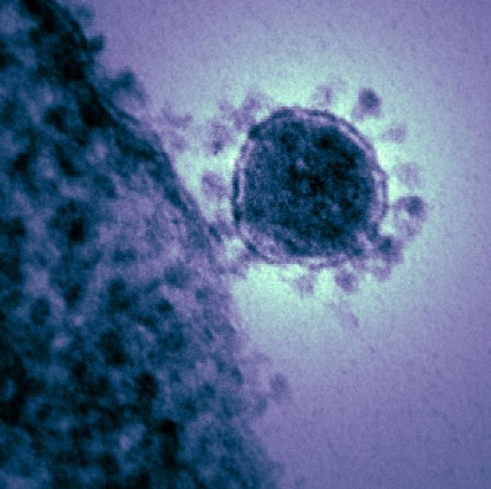 7 Klasifikasi virus corona yang pernah menyerang manusia