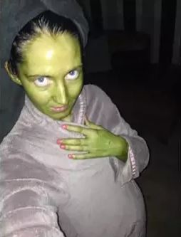 Niat ubah warna kulit, wanita ini alami kejadian apes