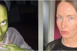 Niat ubah warna kulit, wanita ini alami kejadian apes