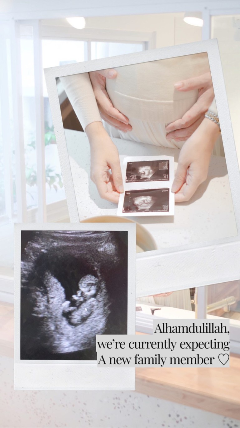 8 Potret Dian Pelangi umumkan hamil anak pertama, selamat!