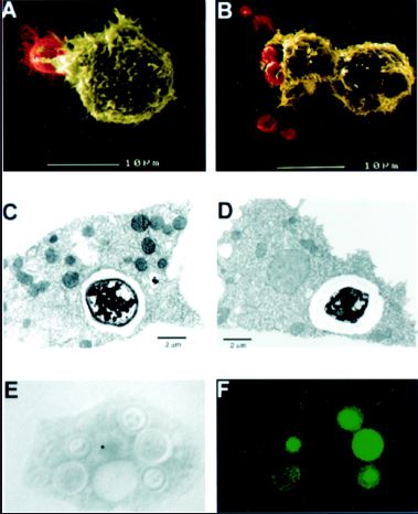 5 Jenis meningitis, penyakit sebabkan Glenn Fredly meninggal dunia