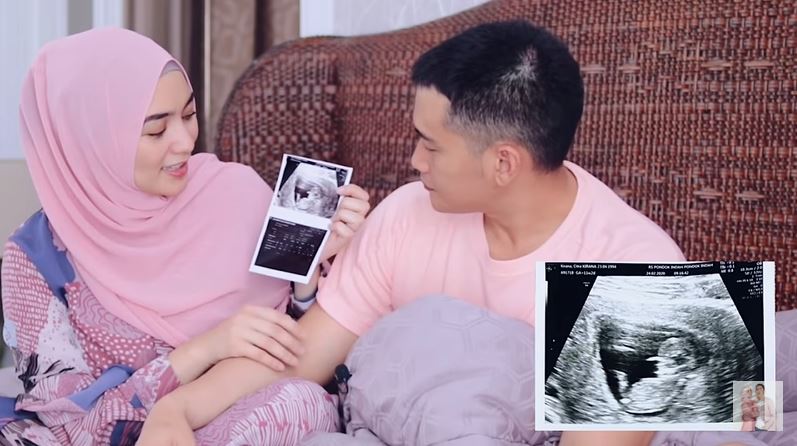 7 Momen Citra Kirana & Rezky cerita tentang kehamilan, penuh doa