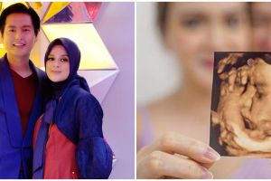 Penampakan janin 6 anak seleb saat USG, posenya jadi sorotan