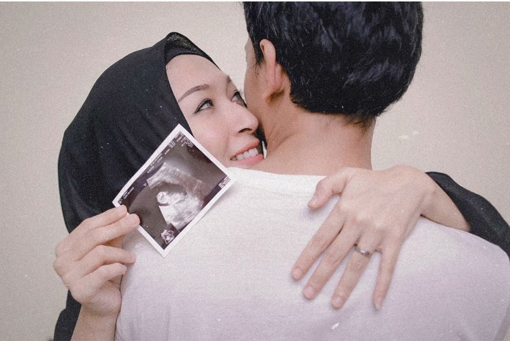Wajah bahagia Fedi Nuril tunjukkan foto calon anak kedua