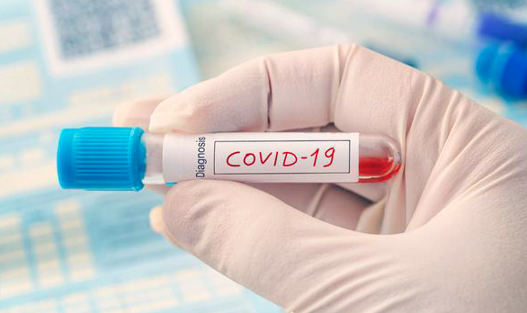 5 Alasan vaksin virus corona Covid-19 belum ditemukan