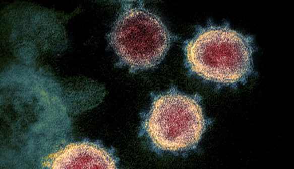 5 Alasan vaksin virus corona Covid-19 belum ditemukan