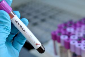 WHO masih yakin virus corona berasal dari hewan, ini penjelasannya