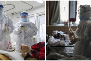 Warna kulit dokter Wuhan menghitam karena corona, ini potretnya