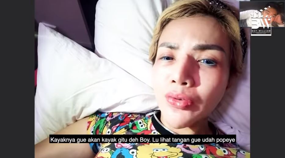 Akui lakukan operasi plastik, ini wajah asli Barbie Kumalasari