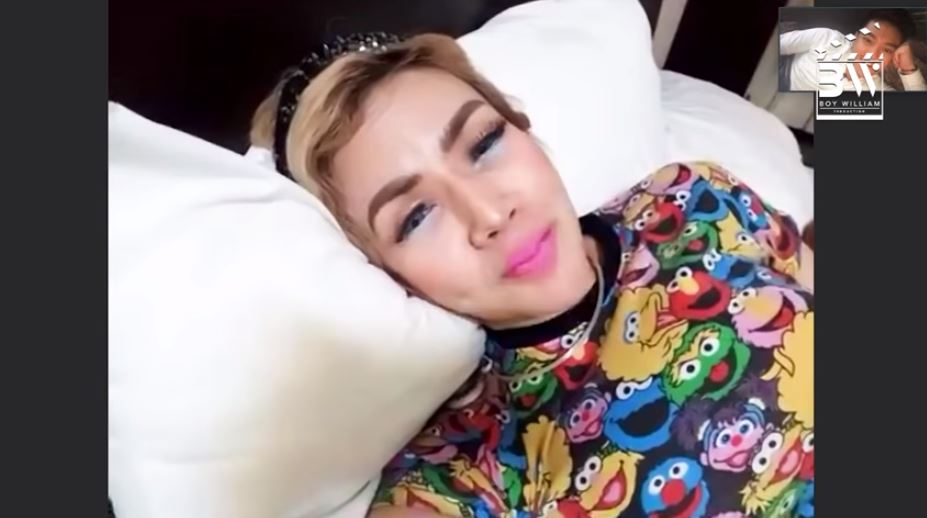 Akui lakukan operasi plastik, ini wajah asli Barbie Kumalasari