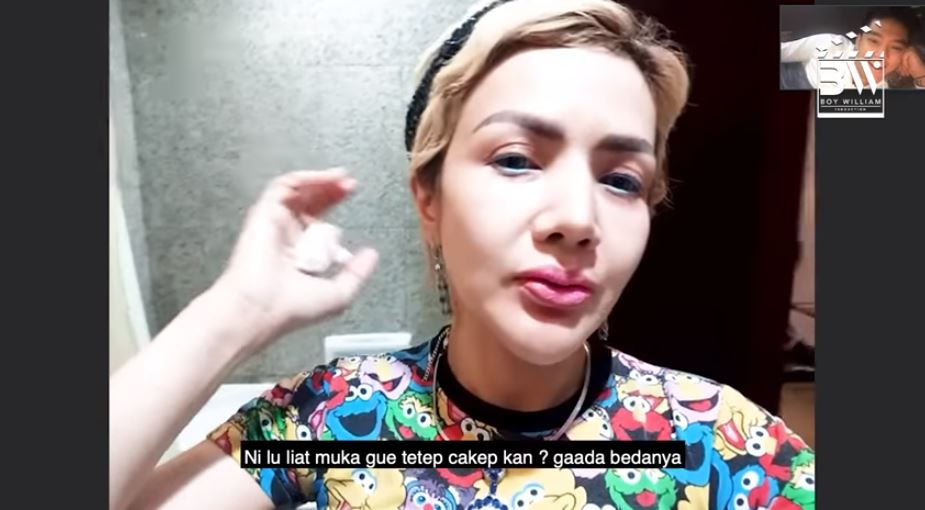 Akui lakukan operasi plastik, ini wajah asli Barbie Kumalasari