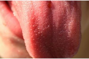 Kisah pria nekat potong lidahnya demi tangkal corona