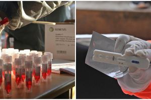 Pasien positif corona di Jakarta mayoritas usia lebih dari 50 tahun