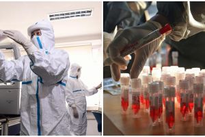 Kabar baik, antibodi virus corona telah ditemukan