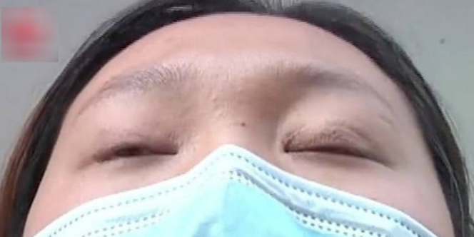 Gagal operasi mata, perempuan ini terpaksa tidur pakai selotip