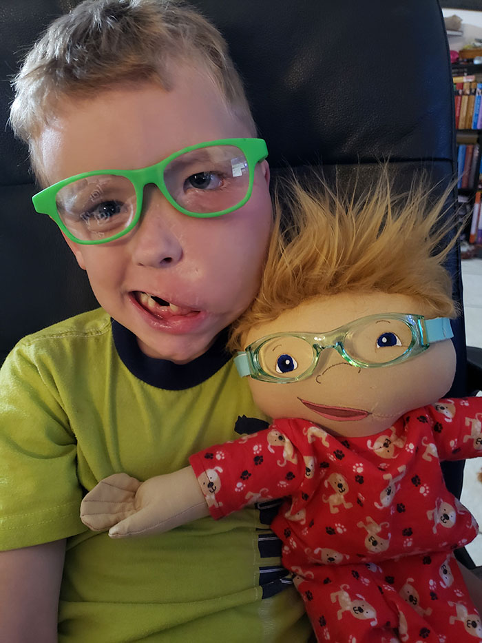15 Potret boneka khusus anak disabilitas, menyentuh hati
