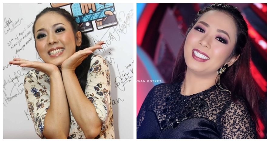 Potret 10 seleb cantik sebelum vs sesudah veneer gigi, manglingi